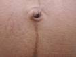 The dark brown line of linea nigra typically extends above and below the belly button.