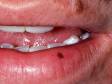 Oral melanotic macules typically have an even, brown color with a regular border.