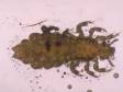 This is a microscopic picture of the head louse.
